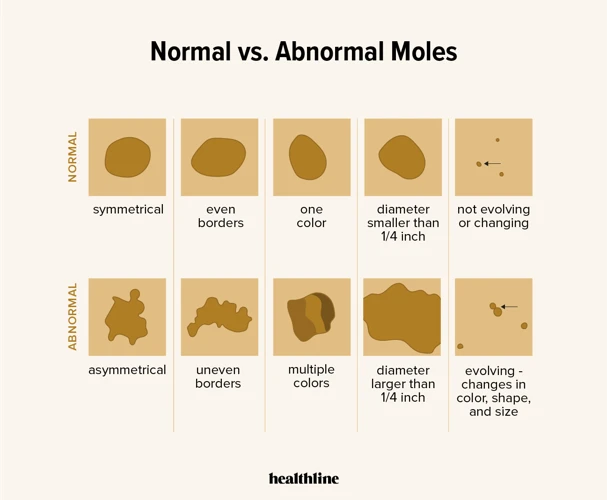 Mole Identification Basics