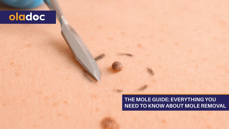 The Nutritional Needs Of Moles